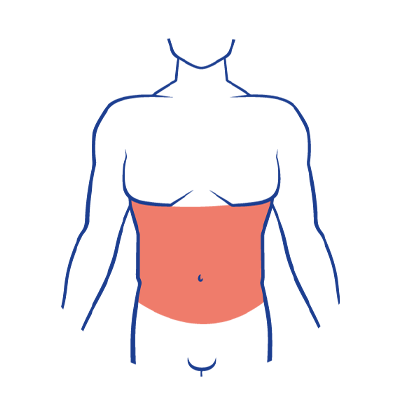 Depilación láser abdomen